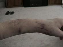My left arm after a wreck into a barbwire fence.                                                                                                                                                        