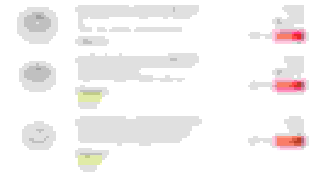 Q5 brake job cost? Page 2 AudiWorld Forums