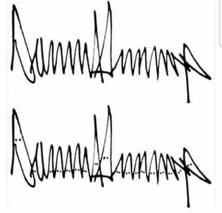 
Stone Cold
‏ @stonecold2050
Jul 23

Trumps signature looks like a Klan rally