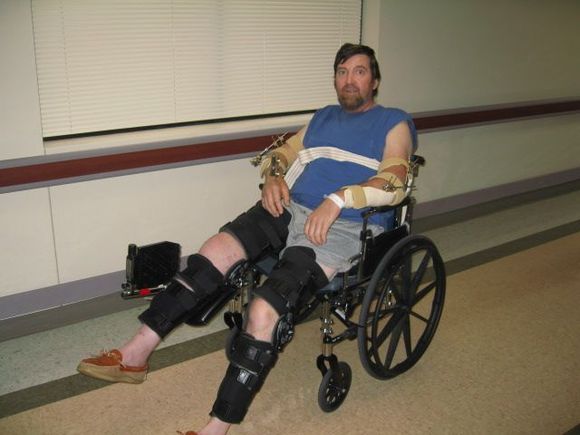 wheel chair w fixatorsIMG 0421