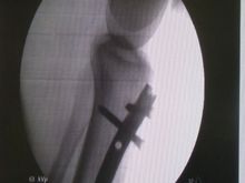 Leg3.jpg