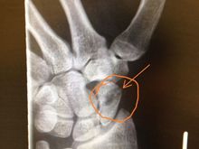 xray2