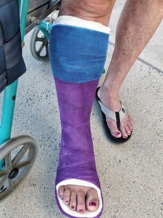 11-7-2017.  Day 8 of cast.