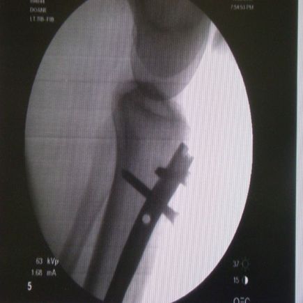 Leg3.jpg