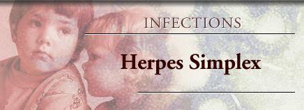 herpes_simplex_infect1.jpg