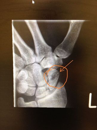 xray2