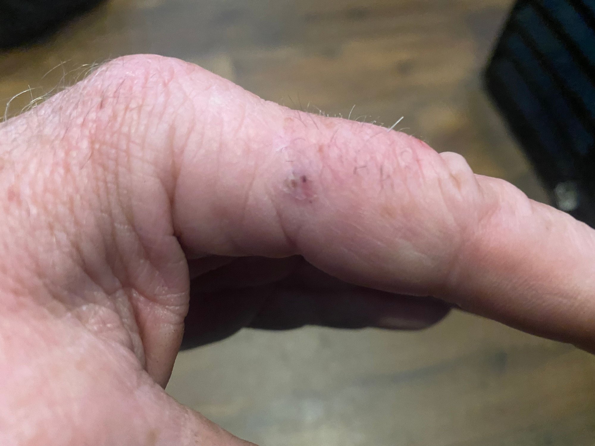 Anyone ever get "Fish Handlers Disease"? Page 5 The Hull Truth